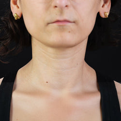 Puces d'oreilles ANCIENNES Renard et chien en or jaune - Castafiore